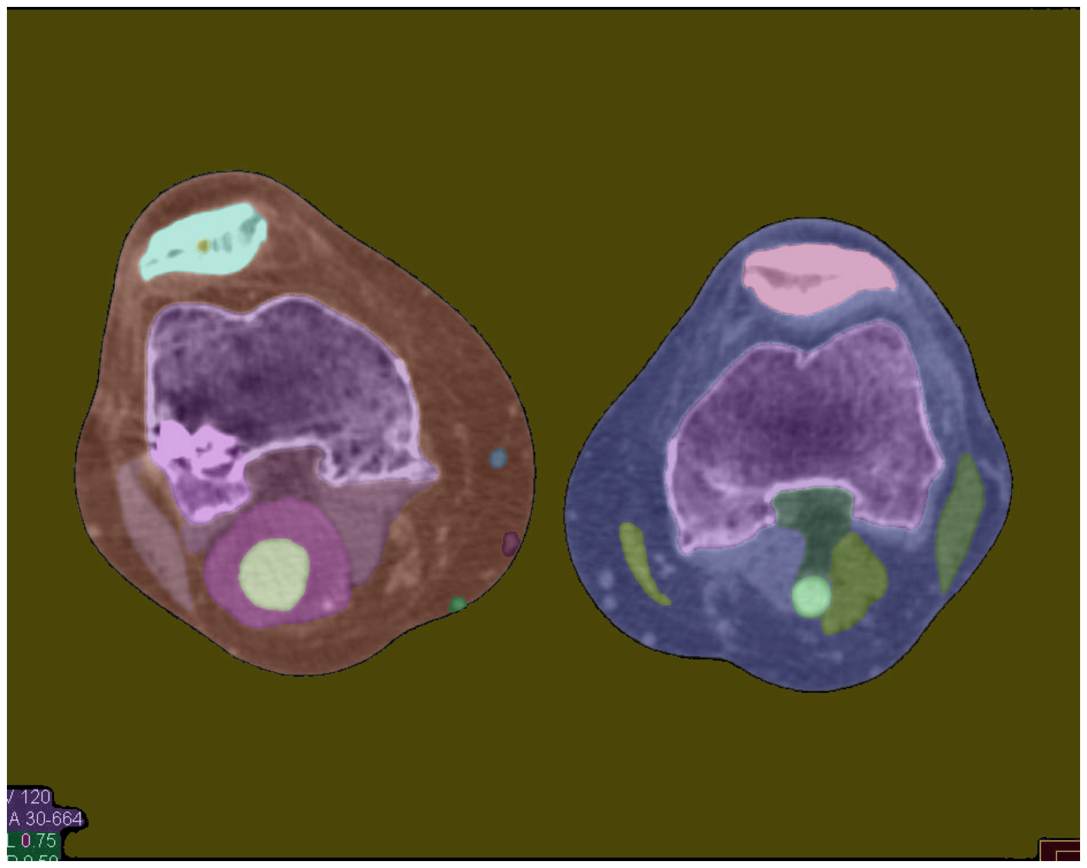 Enhanced Image Segmentation - 317947